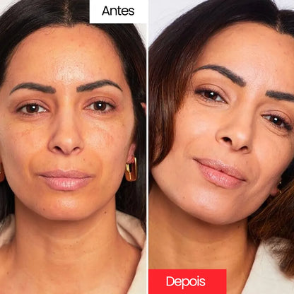 Creme Corretivo - Centella Cream™