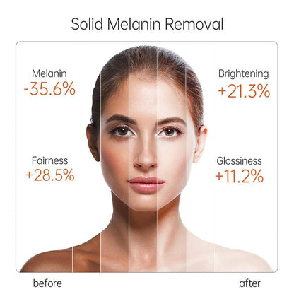 JOY Conjunto Clareamento para Pele - Loja Pediu Levou