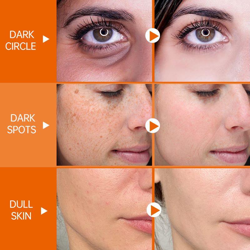 JOY Conjunto Clareamento para Pele - Loja Pediu Levou